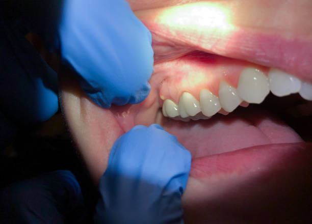 Best Emergency Denture Repair in Sweet Home, AR
